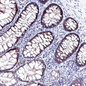 Galectin-9 antibody in Human Colon by Immunohistochemistry (IHC-P).
