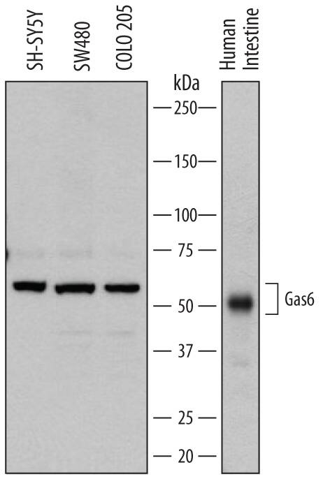 Detection of Human Gas6 antibody by Western Blot.