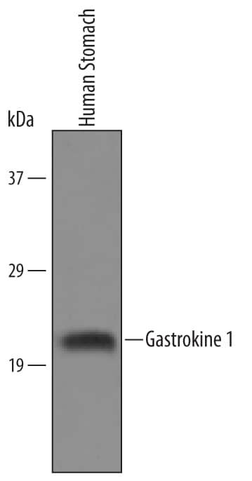 Detection of Human Gastrokine 1 antibody by Western Blot.