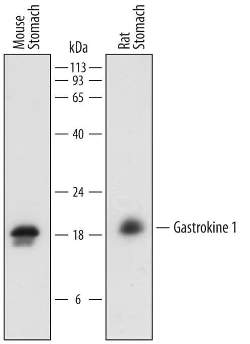 Detection of Mouse and Rat Gastrokine 1 antibody by Western Blot.