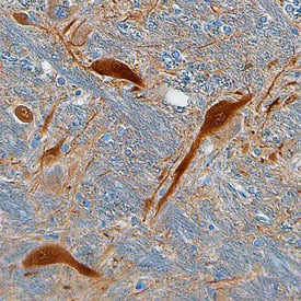 Gephyrin/GPHN antibody in Human Brain by Immunohistochemistry (IHC-P).