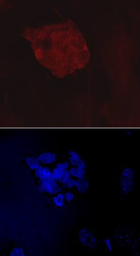 VISTA/B7-H5/PD-1H in BG01V Human Embryonic Stem Cells. VISTA/B7-H5/PD-1H antibody in BG01V Human Embryonic Stem Cells by Immunocytochemistry (ICC).