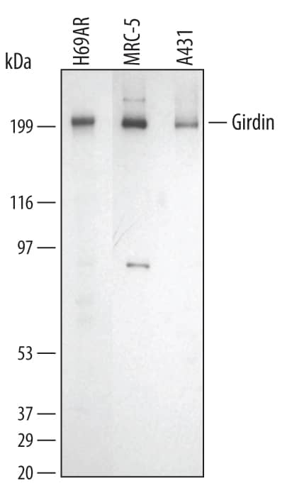 Detection of Human Girdin antibody by Western Blot.