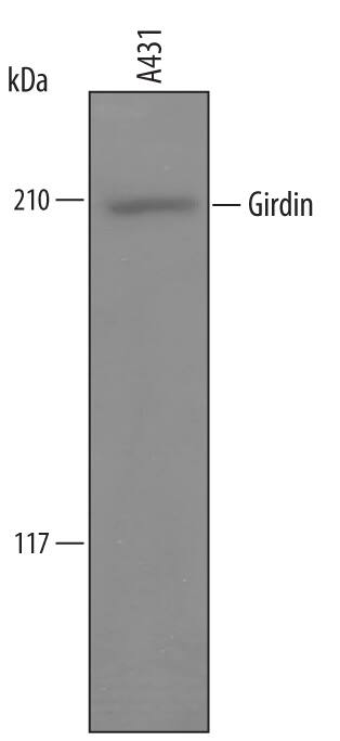 Detection of Human Girdin antibody by Western Blot.