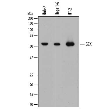 Detection of Human and Mouse Glucokinase/GCK antibody by Western Blot.