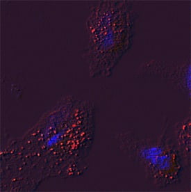 Glucosylceramidase/GBA antibody in HeLa Human Cell Line by Immunocytochemistry (ICC).