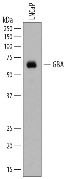 Detection of Human Glucosylceramidase/GBA antibody by Western Blot.