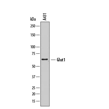 Detection of Human Glut1 antibody by Western Blot.