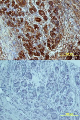 Glut2 antibody in Human Pancreas by Immunohistochemistry (IHC-P).