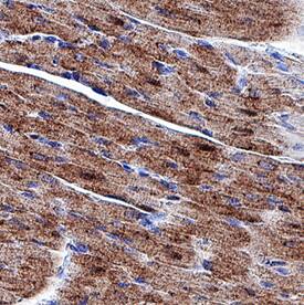 Glut4 antibody in Rat Heart Tissue by Immunohistochemistry (IHC-P).
