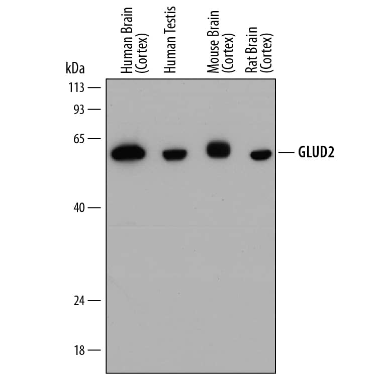 Detection of Human, Mouse, and Rat GLUD2 antibody by Western Blot.