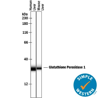 Detection of Human and Mouse Glutathione Peroxidase 1/GPX1 antibody by Simple WesternTM.