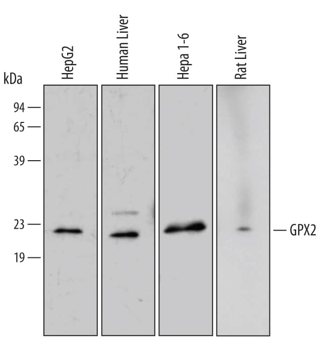 Detection of Human/Mouse/Rat Glutathione Peroxidase 2 antibody by Western Blot.