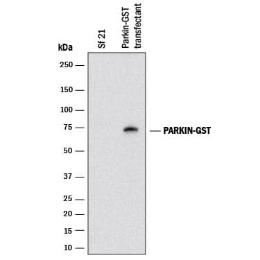 Detection of Glutathione S-Transferase/GST antibody by Western Blot.