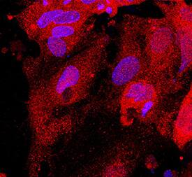 Glutathione S-Transferase pi 1/GSTP1 antibody in BG01V Human Embryonic Stem Cells by Immunocytochemistry (ICC).