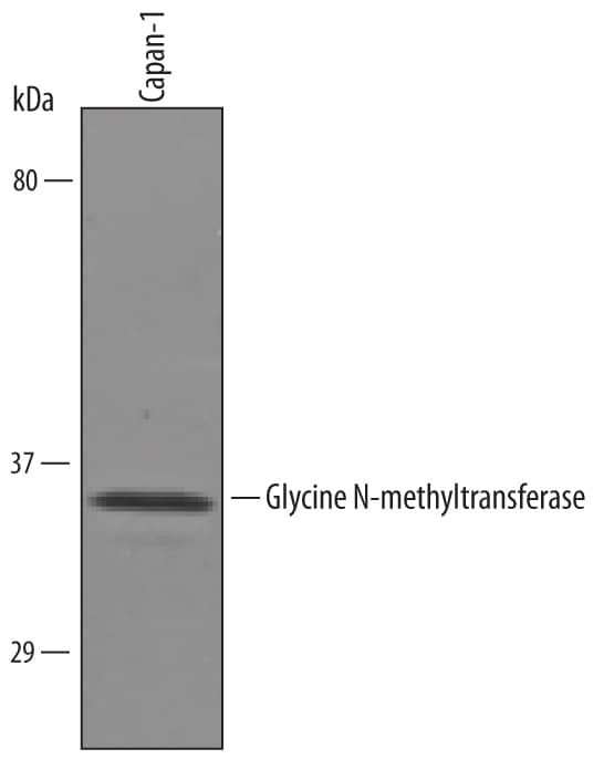 Detection of Human Glycine N-methyltransferase/GNMT antibody by Western Blot.