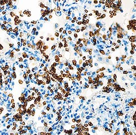 Glycophorin A antibody in Human Lung by Immunohistochemistry (IHC-P).