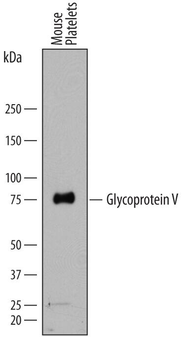 Detection of Mouse Glycoprotein V/CD42d antibody by Western Blot.