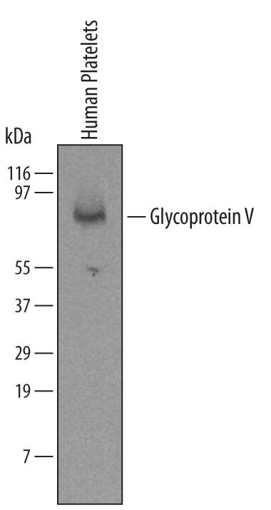 Detection of Human Glycoprotein V/CD42d antibody by Western Blot.