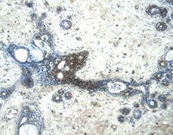 Glypican 3 antibody in Human Breast by Immunohistochemistry (IHC-P).