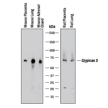 Detection of Mouse and Rat Glypican 3 antibody by Western Blot.