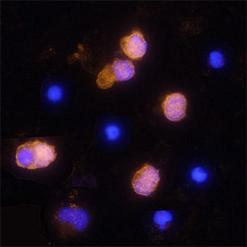 Granzyme A antibody in Human PBMCs by Immunocytochemistry (ICC).