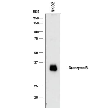 Detection of Human Granzyme B antibody by Western Blot.