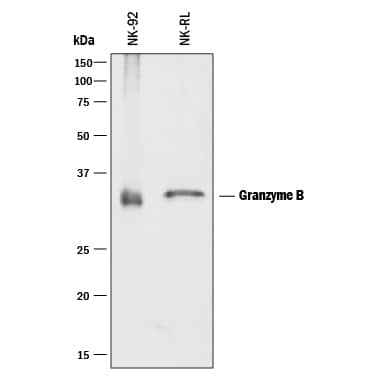 Detection of Granzyme B antibody by Western Blot.