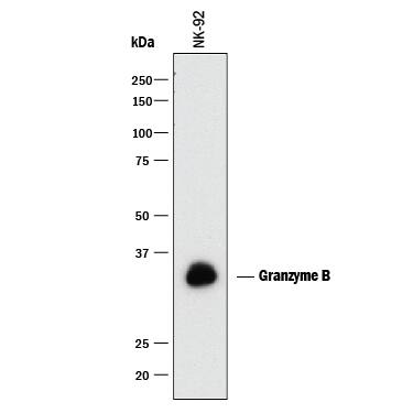 Detection of Human Granzyme B antibody by Western Blot.