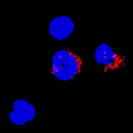 Granzyme H antibody in Human PBMCs by Immunocytochemistry (ICC).