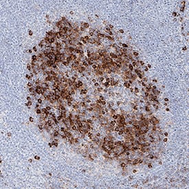 Granzyme K antibody in Human Tonsil by Immunohistochemistry (IHC-P).