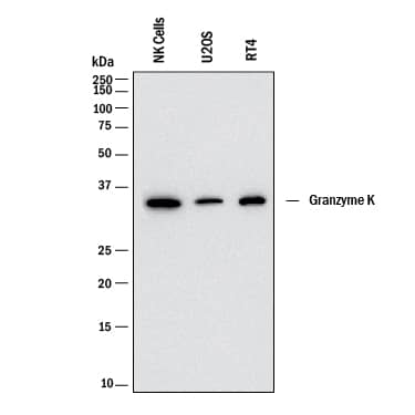 Detection of Human Granzyme K antibody by Western Blot.