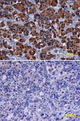Growth Hormone antibody in Human Pituitary by Immunohistochemistry (IHC-P).