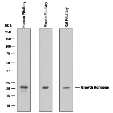 Detection of Human, Mouse, and Rat Growth Hormone antibody by Western Blot.