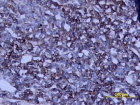 Growth Hormone antibody in Rat Pituitary by Immunohistochemistry (IHC-Fr).