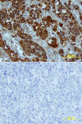 Growth Hormone antibody in Human Pituitary by Immunohistochemistry (IHC-P).