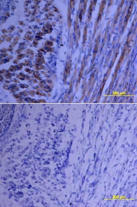Growth Hormone antibody in Mouse Embryo by Immunohistochemistry (IHC-Fr).