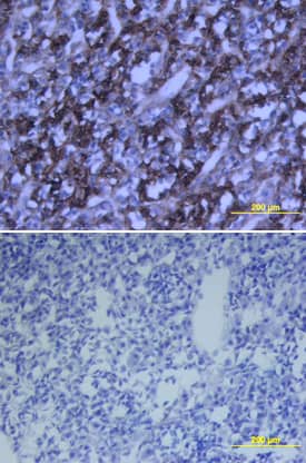 Growth Hormone antibody in Rat Pituitary by Immunohistochemistry (IHC-Fr).