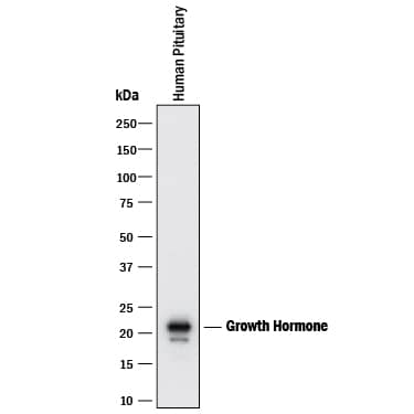 Detection of Human Growth Hormone antibody by Western Blot.