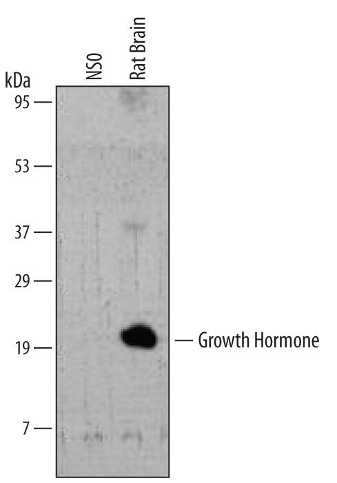 Detection of Rat Growth Hormone antibody by Western Blot.