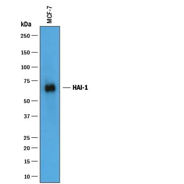 Detection of Human HAI-1 antibody by Western Blot.