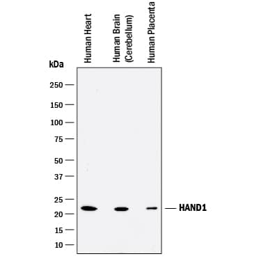 Detection of Human HAND1 antibody by Western Blot.