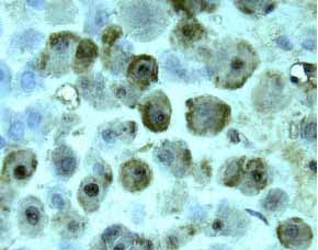 HB-EGF antibody in Human Placenta by Immunohistochemistry (IHC-P).