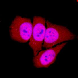 Host Cell Factor 1/HCFC1 antibody in HeLa Human Cell Line by Immunocytochemistry (ICC).
