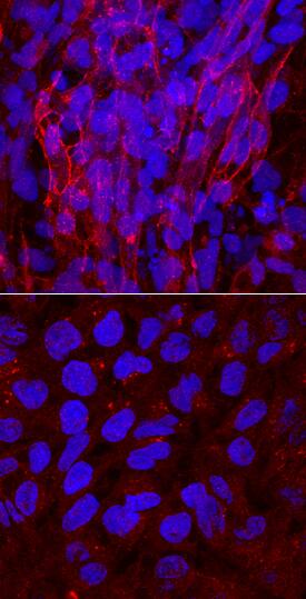 HCN4 antibody in BG01V Human Embyonic Stem Cells by Immunocytochemistry (ICC).