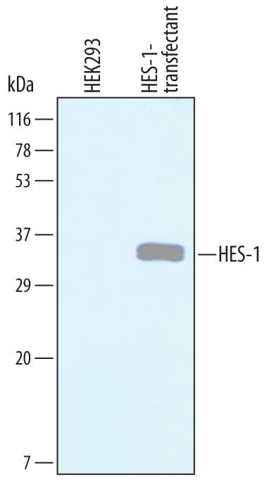 Detection of Human HES-1 antibody by Western Blot.