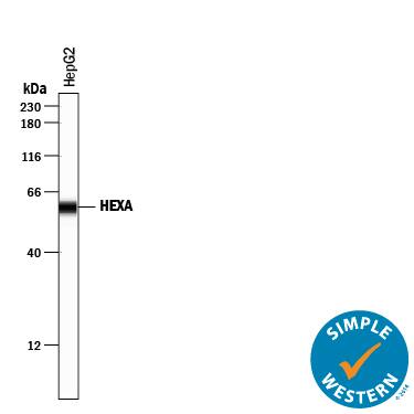 Detection of Human Hexosaminidase A/HEXA antibody by Simple WesternTM.