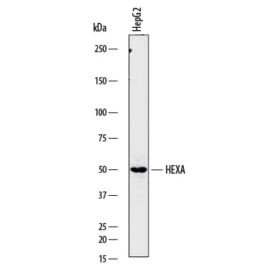 Detection of Human Hexosaminidase A/ HEXA antibody by Western Blot.