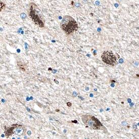 Hexosaminidase A/HEXA antibody in Human Brain by Immunohistochemistry (IHC-P).