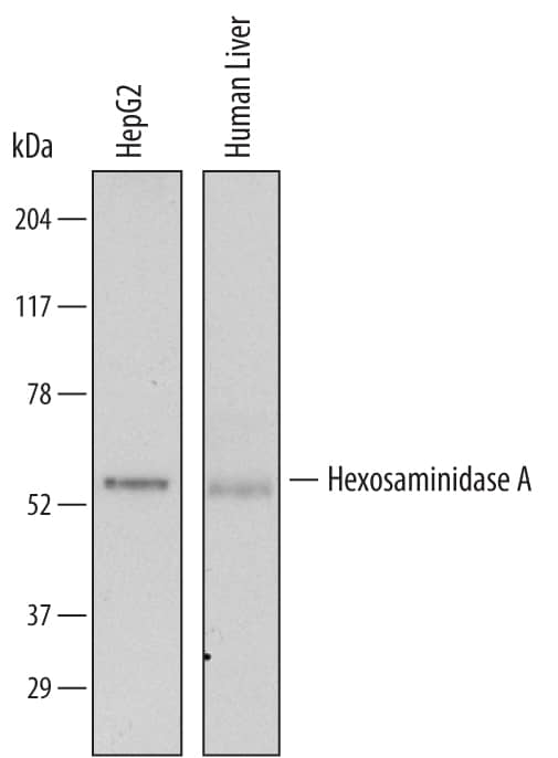 Detection of Human Hexosaminidase A/HEXA antibody by Western Blot.